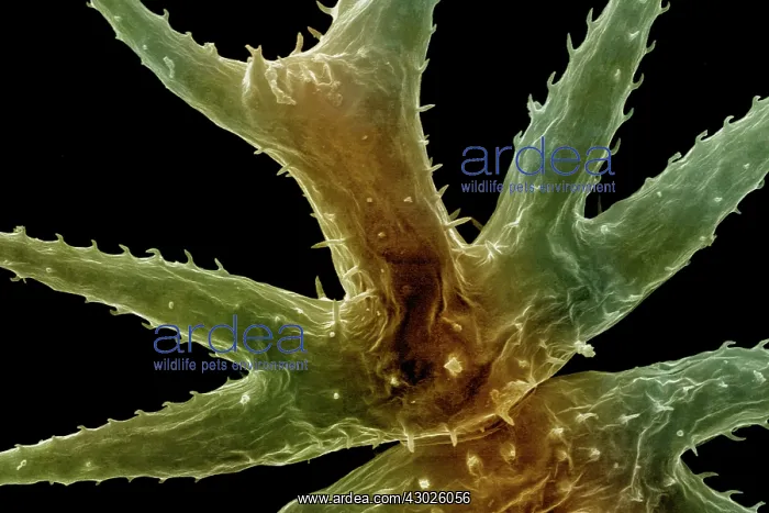 : Scanning Electron Micrograph (SEM): Freshwater Desmid : Scanning Electron Micrograph (SEM): Freshwater Desmid