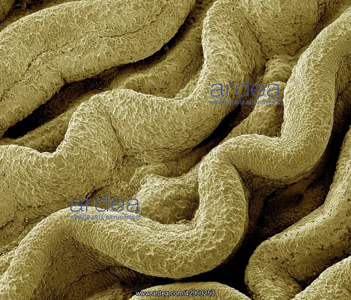 : Scanning Electron Micrograph (SEM): Human Fallopian tube : Scanning Electron Micrograph (SEM): Human Fallopian tube