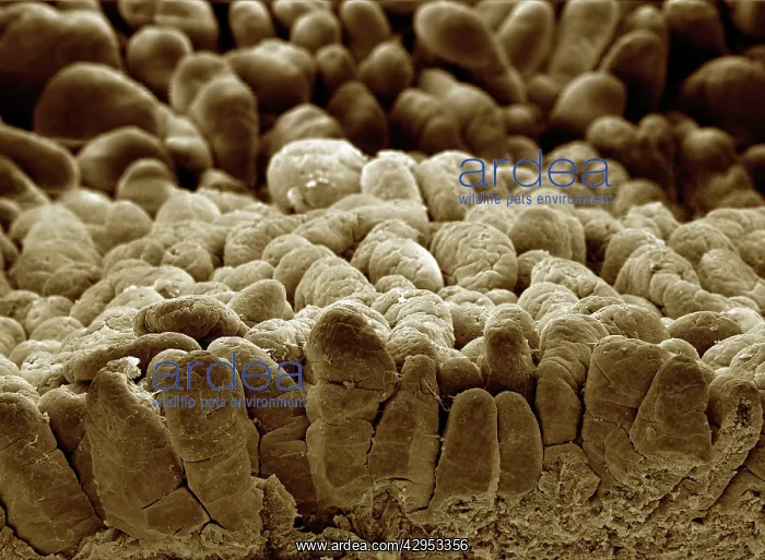 : Scanning Electron Micrograph (SEM): human intestine : Scanning Electron Micrograph (SEM): human intestine