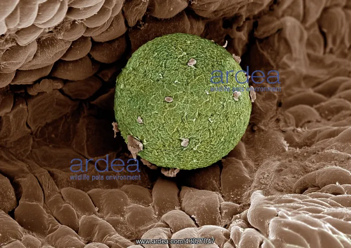 : Scanning Electron Micrograph (SEM); Human Ovum in : Scanning Electron Micrograph (SEM); Human Ovum in