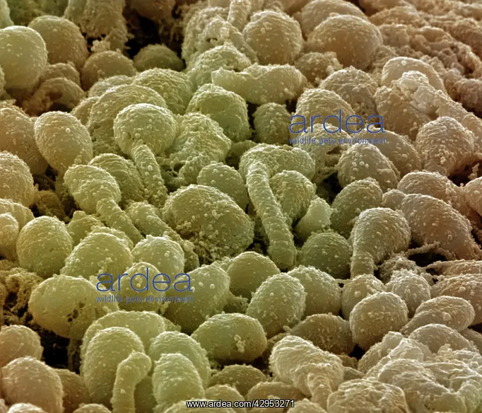 : Scanning Electron Micrograph (SEM): Human Retina : Scanning Electron Micrograph (SEM): Human Retina
