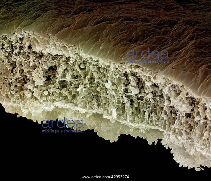 : Scanning Electron Micrograph (SEM): Human Retina : Scanning Electron Micrograph (SEM): Human Retina