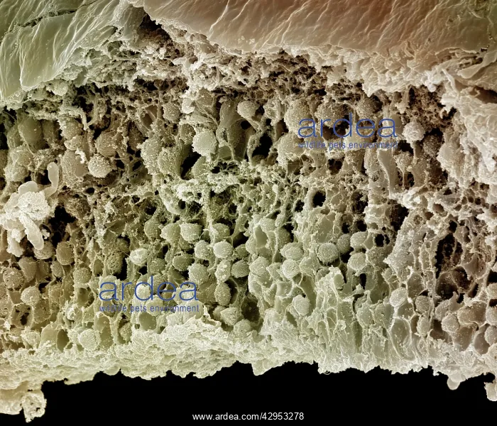 : Scanning Electron Micrograph (SEM): Human Retina : Scanning Electron Micrograph (SEM): Human Retina