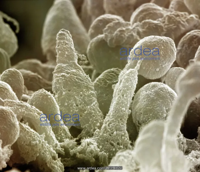 : Scanning Electron Micrograph (SEM): Human Retina : Scanning Electron Micrograph (SEM): Human Retina