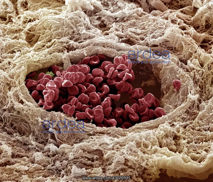  : Scanning Electron Micrograph (SEM): Human skin section