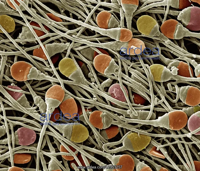 : Scanning Electron Micrograph (SEM): Human sperm : Scanning Electron Micrograph (SEM): Human sperm