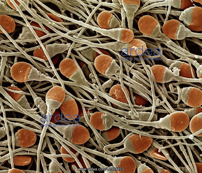 : Scanning Electron Micrograph (SEM): human sperm : Scanning Electron Micrograph (SEM): human sperm