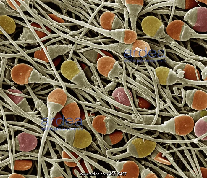 : Scanning Electron Micrograph (SEM): human sperm : Scanning Electron Micrograph (SEM): human sperm