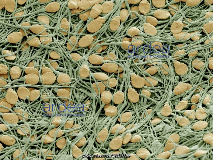 : Scanning Electron Micrograph (SEM); Human sperm cells : Scanning Electron Micrograph (SEM); Human sperm cells