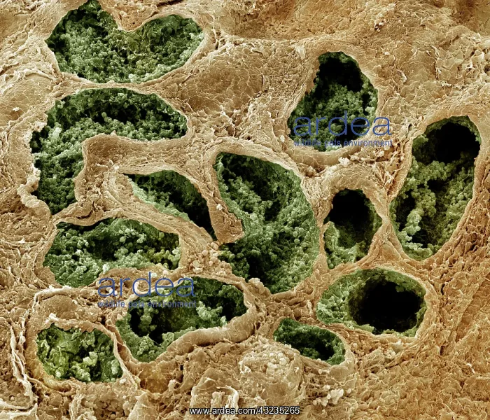 : Scanning Electron Micrograph (SEM): Human testis : Scanning Electron Micrograph (SEM): Human testis