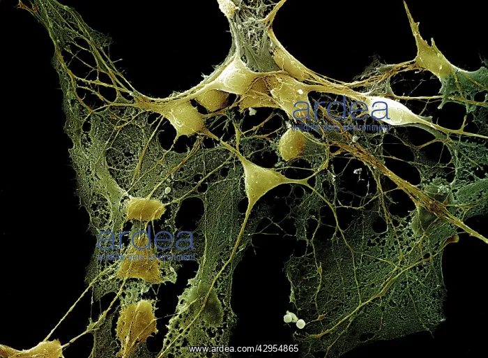 : Scanning Electron Micrograph (SEM): Nerve cells : Scanning Electron Micrograph (SEM): Nerve cells