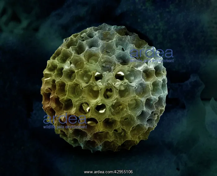 : Scanning Electron Micrograph (SEM): Spumellarian Radiolaria : Scanning Electron Micrograph (SEM): Spumellarian Radiolaria