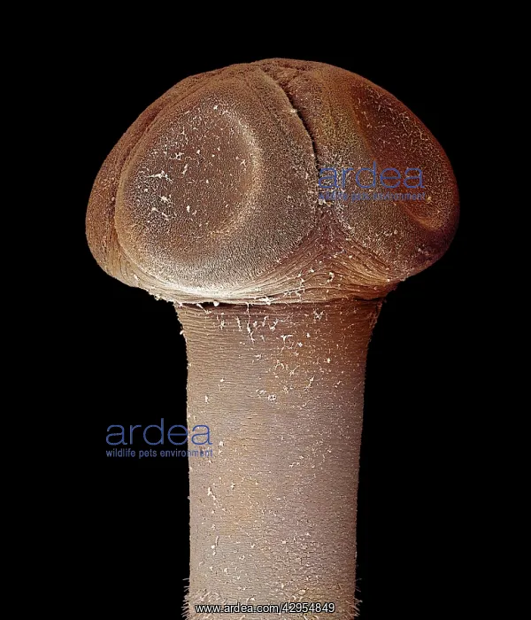 : Scanning Electron Micrograph (SEM): Tapeworm from : Scanning Electron Micrograph (SEM): Tapeworm from