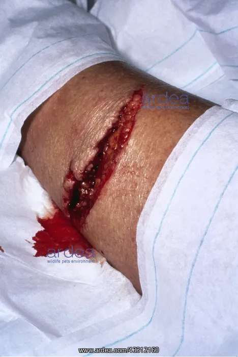 : Shark attack victim - bite on leg wound (Valerie : Shark attack victim - bite on leg wound (Valerie