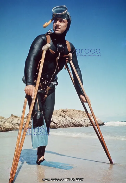 : Shark attack victim - lost leg to Great White Shark : Shark attack victim - lost leg to Great White Shark
