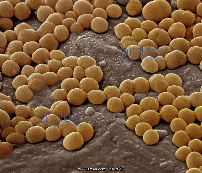  : Staphylococcus aureus bacteria