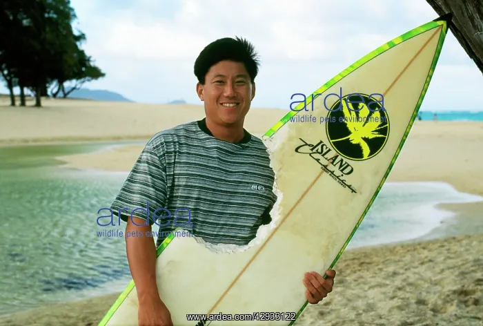 : Surfer after attack by Tiger Shark - holding board : Surfer after attack by Tiger Shark - holding board