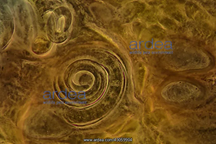 : Trichinella spiralis encysted in pork muscle : Trichinella spiralis encysted in pork muscle