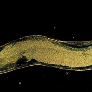 Dark Field Light Micrograph (LM): Human Pinworm Dark Field Light Micrograph (LM): Human Pinworm