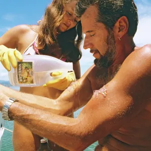 First aid treatment for sting of Box jellyfish (Chironex First aid treatment for sting of Box jellyfish (Chironex