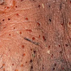 Hippopotamus Skin - Pink sweat Hippopotamus Skin - Pink sweat