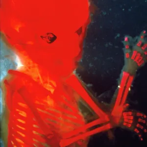 Human Foetus 12 weeks - red dye to show bones Human Foetus 12 weeks - red dye to show bones