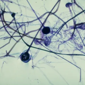 Light Micrograph (LM): Rhizopus sporangia Light Micrograph (LM): Rhizopus sporangia