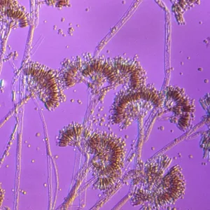 Light Micrograph showing fruiting bodies (conidiophores) Light Micrograph showing fruiting bodies (conidiophores)