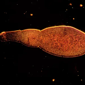 Light Micrograph: Tapeworm Light Micrograph: Tapeworm