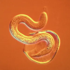 Light Micrograph using Nomarski Technique: Intestinal Light Micrograph using Nomarski Technique: Intestinal