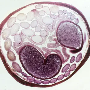 ROUNDWORM -T.Section of horse roundworm