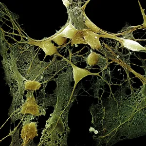 Scanning Electron Micrograph (SEM) Scanning Electron Micrograph (SEM)