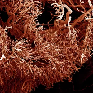 Scanning Electron Micrograph (SEM): a corrosion Scanning Electron Micrograph (SEM): a corrosion