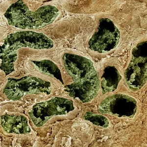 Scanning Electron Micrograph (SEM): Human testis Scanning Electron Micrograph (SEM): Human testis