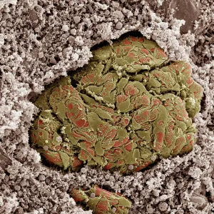 Scanning electron micrograph (SEM) of Kidney glomerulus Scanning electron micrograph (SEM) of Kidney glomerulus