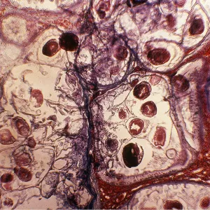 TAPE WORM - X 20 magnification