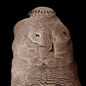 Tapeworm Tapeworm