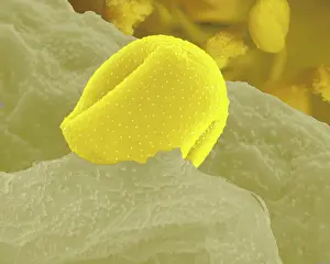 Microscope: Aconite Anther - with pollen