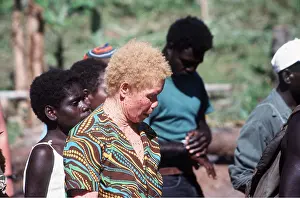 Albino: Albino Bougainville Woman