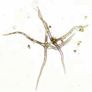 Unexplained: Algae
