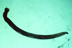 Emma Coghlan: American Hookworm x 5 magnification