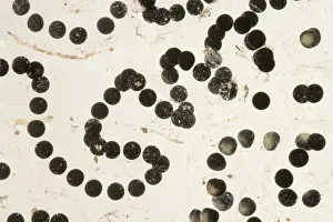 Anurans: American Toad eggs