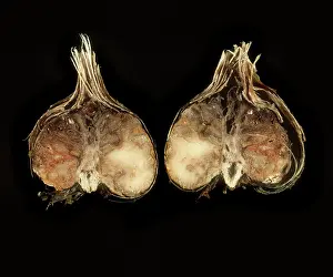 Basal: Basal Rot of Freesia Bulb
