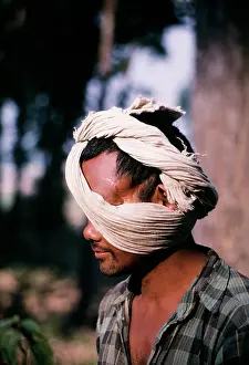 Encroachment: Bengal / Indian Tiger Injury - Nepali with scars