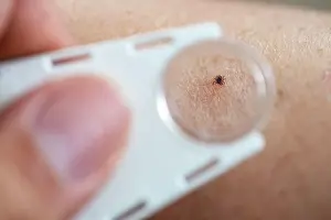 Tick: Castor Bean Tick (Ixodes ricinus), tick, view through