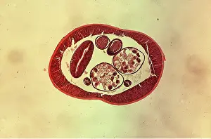 Emma Coghlan: Cat roundworm - cross section Toxascaris - X 15