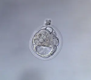 Micro: Cavitated Mouse Blastocyst