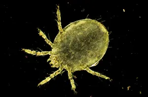 Mites: Dark Field Light Micrograph: Harvest Mite Chigger