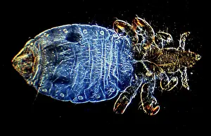Lice: Dark Field Light Micrograph Human Head Louse