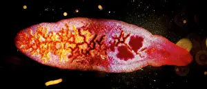 Fluke: Dark Field Light Micrograph: Lancet Liver Fluke